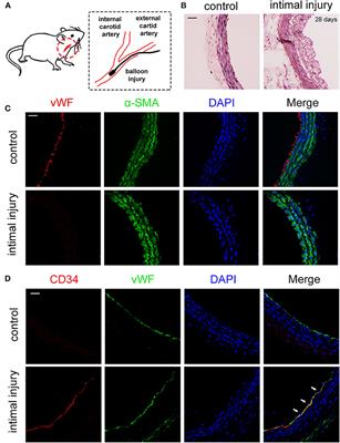 Cyclic Stretch Induces Vascular Smooth Muscle Cells to Secrete Connective Tissue Growth Factor and Promote Endothelial Progenitor Cell Differentiation and Angiogenesis